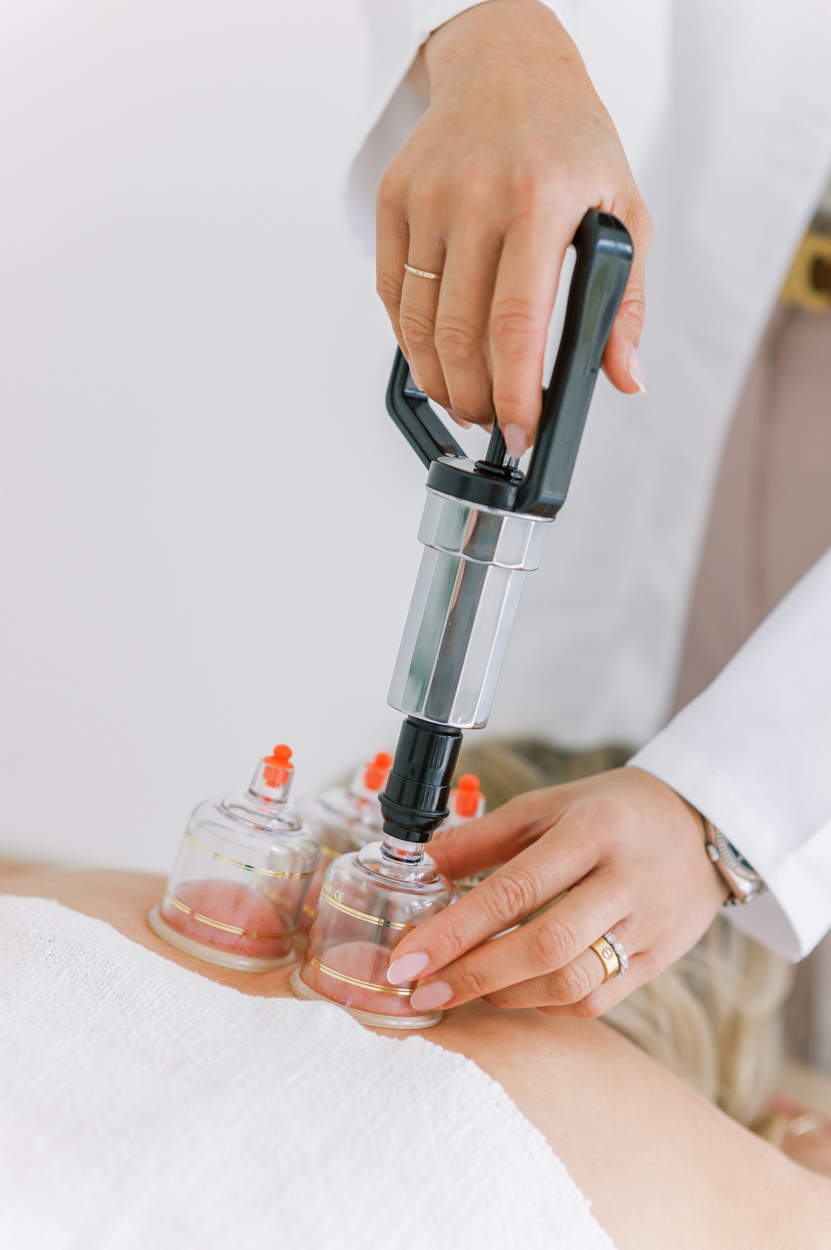 Cupping Therapy – Cheung's Wellness