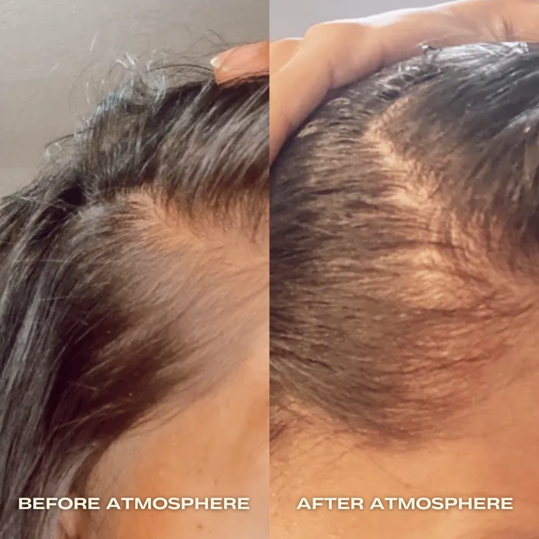ATMOSPHERE MULTI-PEPTIDE HAIR DENSITY & SCALP SERUM