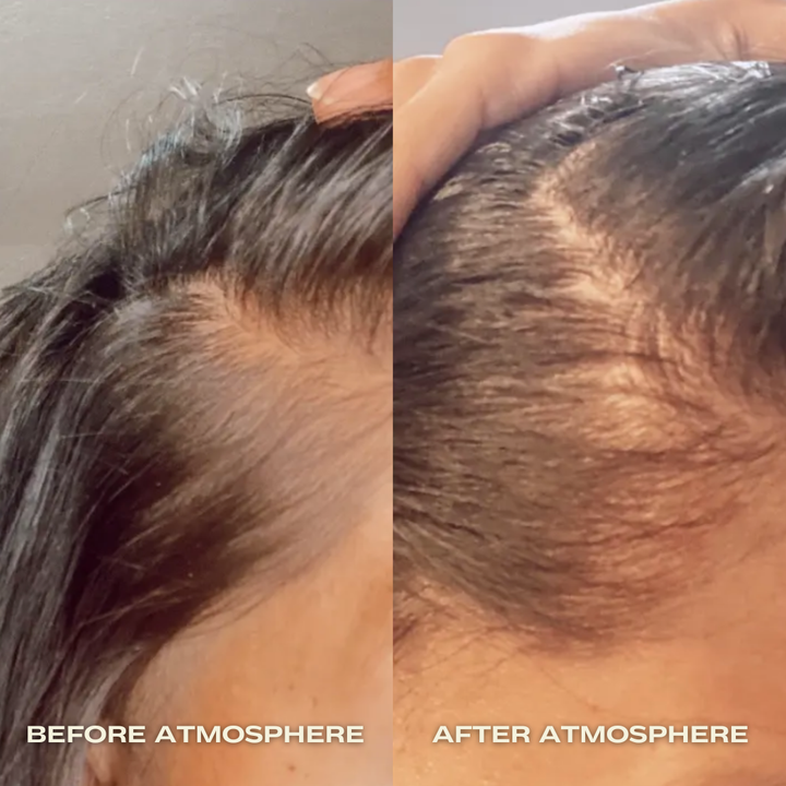 ATMOSPHERE MULTI-PEPTIDE HAIR DENSITY & SCALP SERUM