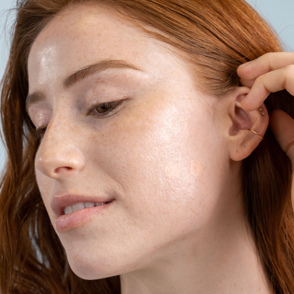 DERMADOT INVISIBLE PIMPLE PATCHES