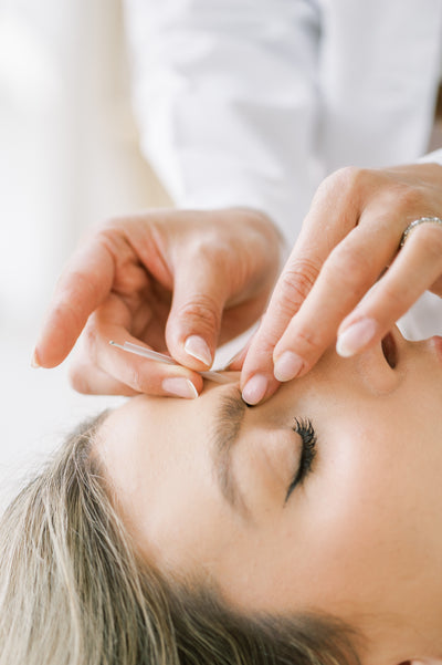 Cosmetic Acupuncture